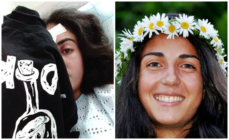 "გადავუნერგოთ მაკოს თვალი" - აქციაზე დაშავებული გოგონას დასახმარებლად ფეისბუქ-აქციას იწყებენ