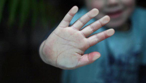 აუტიზმის მქონე 9 წლის ბავშვი, რომელსაც მამა ქამრით სცემდა, პროკურატურამ და სასამართლომ დაზარალებულად არ მიიჩნია