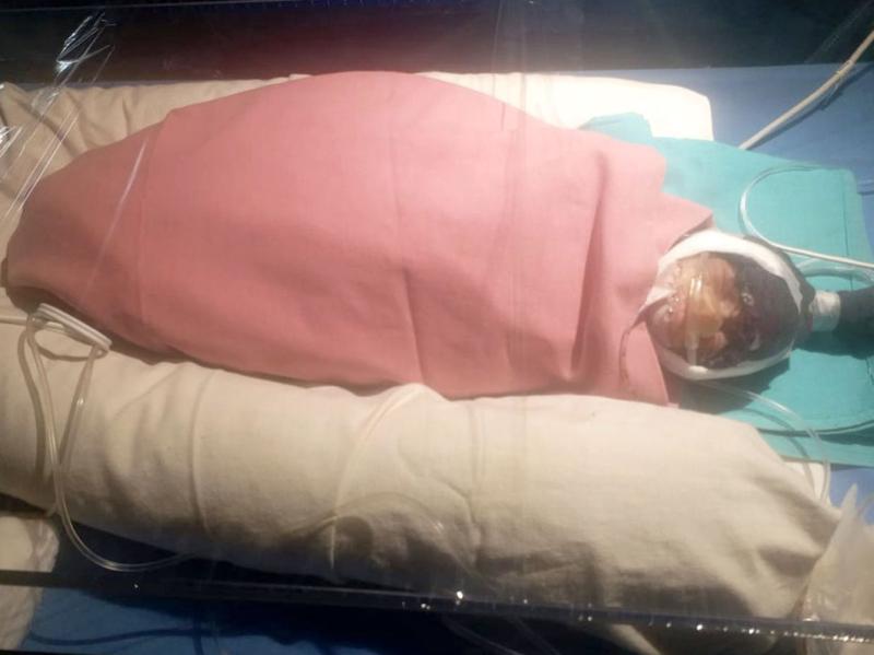 75 წლის ქალმა იმშობიარა - ბავშვის წონა 600 გრამია