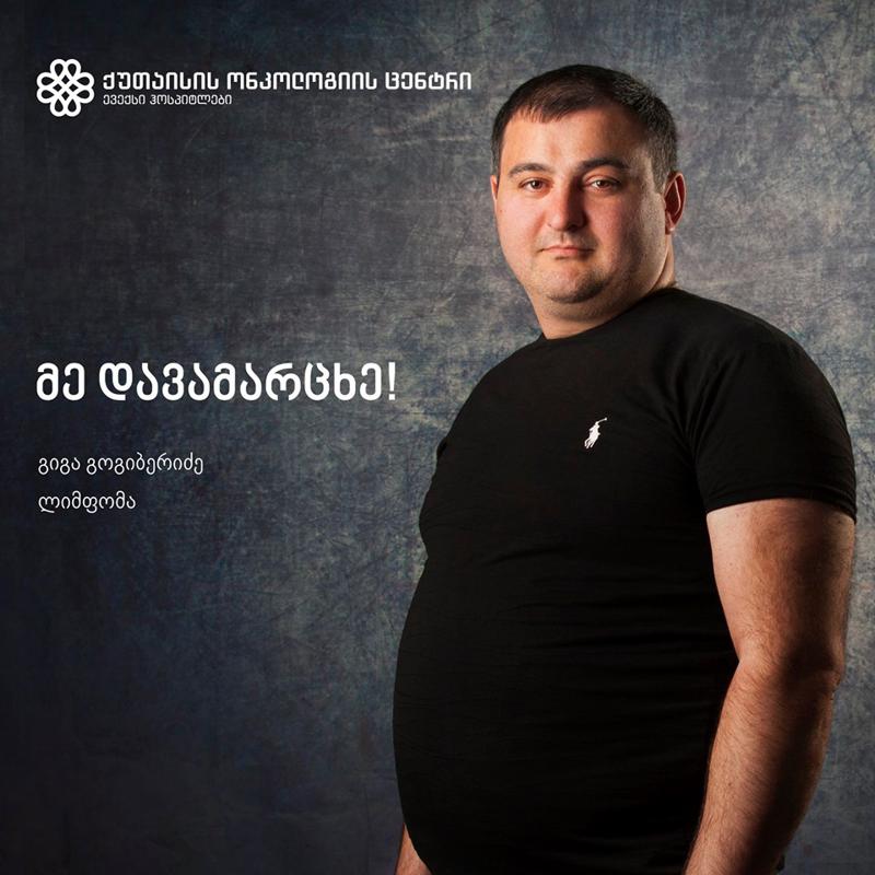 "კიბოს დიაგნოზი რომ დამისვეს, ორი დღე ხმა არ ამომიღია, დავდუმდი" - 31 წლის მამაკაცის ამბავი, რომელმაც სიმსივნე დაამარცხა