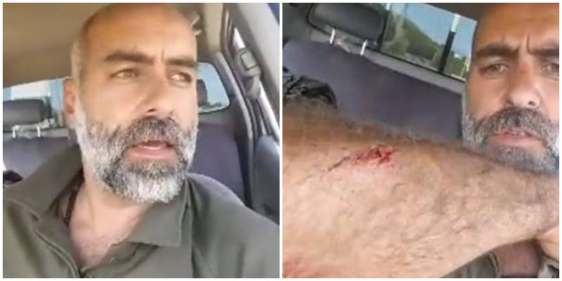 დავით ქაცარავას სცემეს: "პოლიცია იქვე იყო და ვერ შეაჩერა თავდასხმა... მივდივარ საავადმყოფოში"