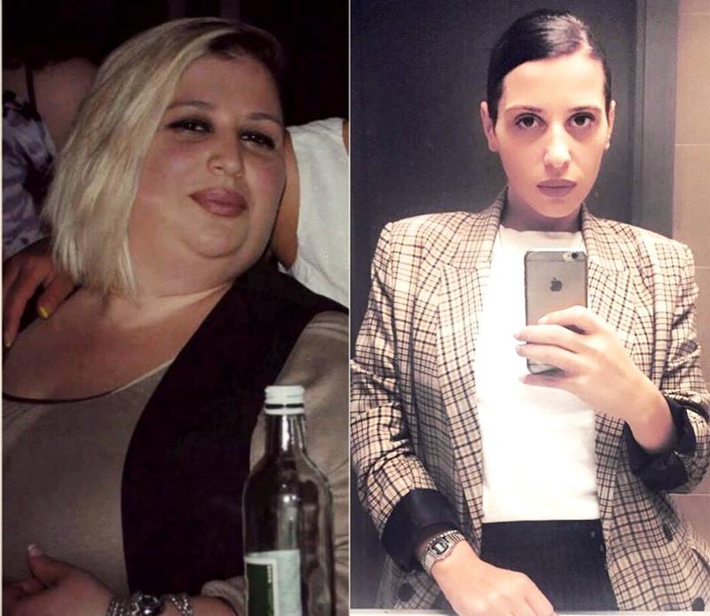 ბათუმელი გოგონას ისტორია, რომელმაც 100 კილოგრამი დაიკლო - "მიყვარდა ცომეული, შემეძლო დღეში ორი მთლიანი პური მეჭამა"