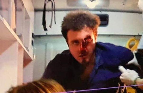 "ექიმებმა, ფაქტობრივად, სასწაული ჩაიდინეს!" - 24 წლის დემეტრე ნაყოფიას თვალი შეუნარჩუნდა