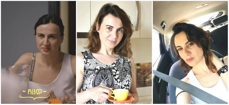 "ერთ დღესაც ძალიან მომინდა იმიჯი შემეცვალა" - როგორ გამოიყურება "ლუნა" ცხვირის ოპერაციის შემდეგ