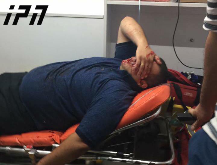 არსებული ინფორმაციით, რუსთაველზე განვითარებული მოვლენების დროს მოქალაქემ თვალი დაკარგა