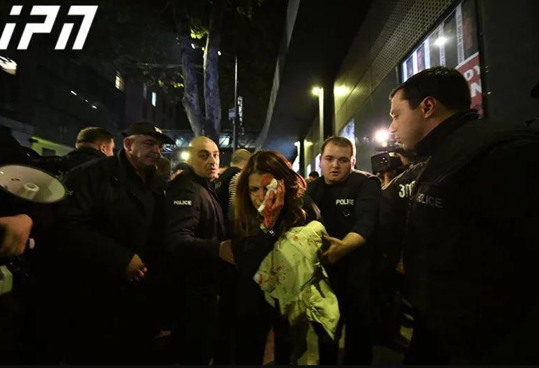 კაცს, რომელმაც ანა სუბელიანს ფიზიკური შეურაცხყოფა მიაყენა, ბრალი წაუყენეს