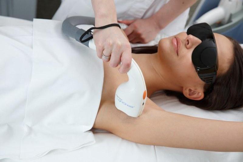 "ეპილაციას ზაფხულში ხშირად იკეთებენ, ვიდრე ზამთარში, რეალურად პროცედურა სიცივეში უფრო ეფექტურია" - რჩევები სპეციალისტისგან