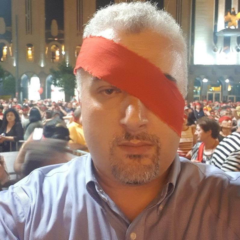 "წყვილი მისცემოდა სასიამოვნო საქმეს... თავს დაატყდათ 4 დეპუტატი და 50 პოლიციელი" - სერგი კაპანაძე კურიოზის შესახებ წერს