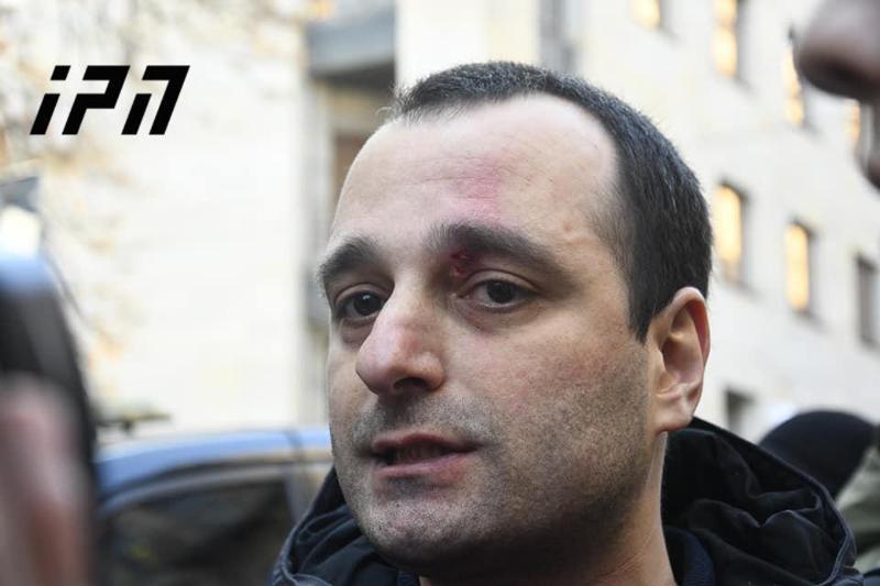 ეროვნულ ბიბლიოთეკასთან დაპირისპირებისას ირაკლი აბესაძემ სახის არეში დაზიანება მიიღო