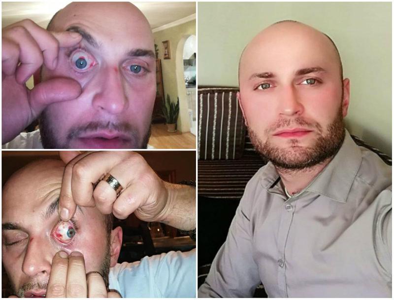 "ხმა ჩამესმოდა, გეყოფათ, ნუ მოკლავთო!" - რას ჰყვება ბიჭი, რომელიც ლაგოდეხელ პოლიციელებს ძალადობაში ადანაშაულებს