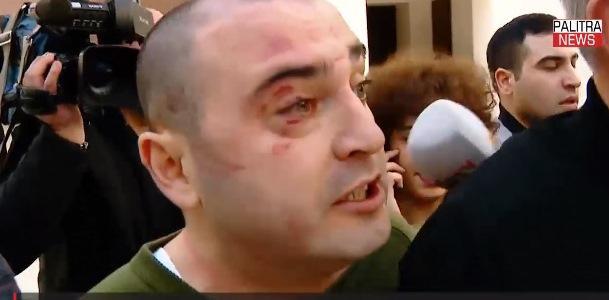 ლევან ხაბეიშვილზე ძალადობის ფაქტზე, თბილისის საკრებულოს სამ წევრს ბრალი წარედგინათ