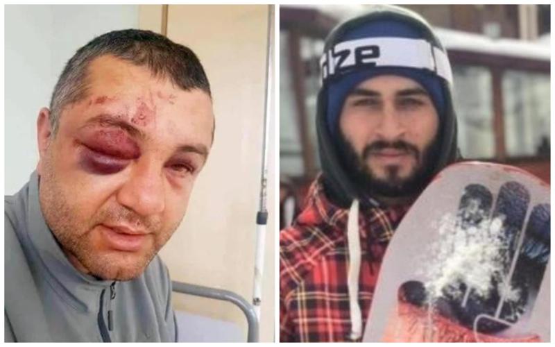 გუდაურის მკვლელობის საქმე: მერაბ კობიაშვილს ბრალი დაუმძიმდა