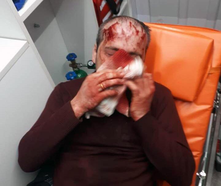 ზვიად კუპრავა პოლიციაში გამოკითხვაზე დაიბარეს