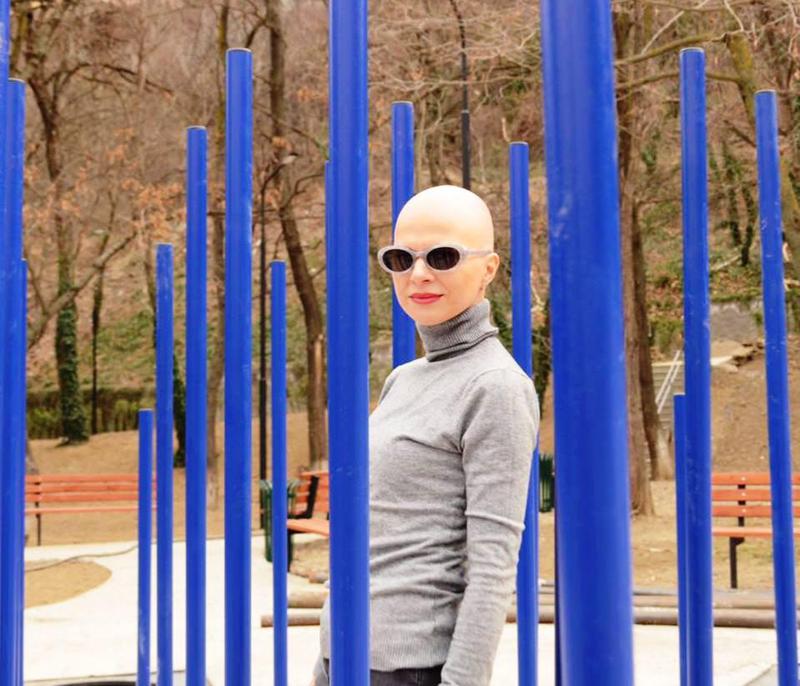 "შვილივით მიმიღო ქმრის ოჯახმა, არასოდეს უგრძნობინებიათ, რომ განსხვავებული ვარ" - ცხოვრება თმების გარეშე და ქალი, რომელიც ალოპეციას დაუმეგობრდა