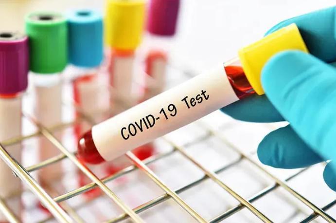 საქართველოში კორონავირუსით ინფიცირების შემთხვევათა რაოდენობა 77-მდე გაიზარდა