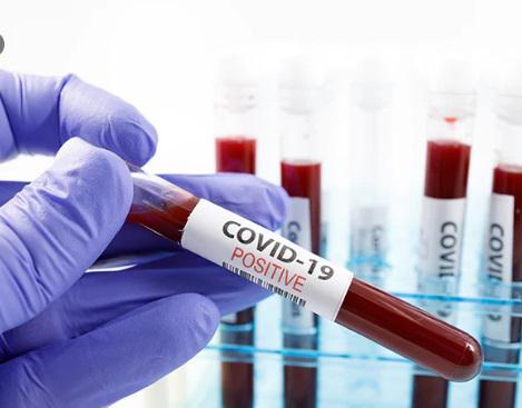 კორონავირუსის 3 ახალი შემთხვევა - სა­ქარ­თვე­ლო­ში ინ­ფი­ცი­რე­ბულთა რიცხვი 134 -მდე გა­ი­ზარ­და