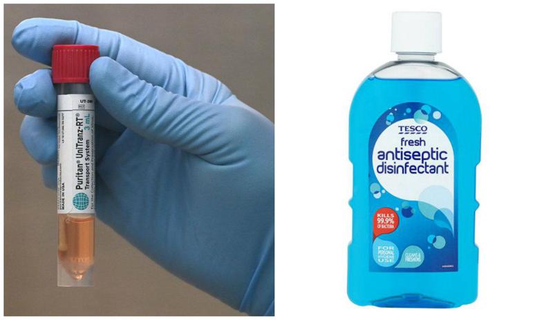 როგორ დავამზადოთ სახლის პირობებში ანტისეპტიკური ხსნარი - იმუნოლოგი WHO-ს რეცეპტს გვიზიარებს