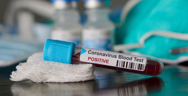 "კომენტარებს ვაწყდები, თითქოს უამრავი დაავადება ჰქონდა და კორონა არ არსებობს, უტიფრები ხართ" - რას წერს COVID-19-ით გარდაცვლილი მე-14 პაციენტის შვილი