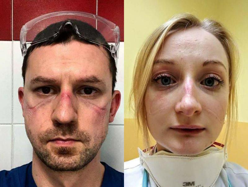 "მეშინია სამსახურში წასვლის, დავიღალე..." - როგორ გამოიყურებიან და რას ჰყვებიან ექიმები, რომლებიც კორონავირუსთან ბრძოლის წინა ხაზზე არიან