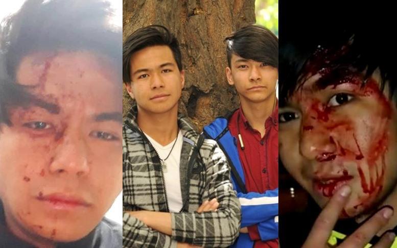 თბილისში ავღანეთიდან ჩამოსულ ძმებს სცემეს, რადგან ჩინელები ეგონათ - "დისკრიმინაცია აქამდეც ყოფილა, ბევრი ფიქრობს, რომ ტერორისტი ვარ ან ნარკოტიკებს ვყიდი"