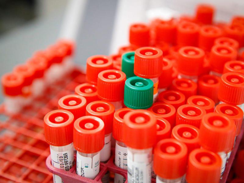 სა­ქარ­თვე­ლო­ში კო­რო­ნა­ვირუ­სით ინ­ფი­ცი­რე­ბის შემ­თხვე­ვები 623-მდე გაიზარდა