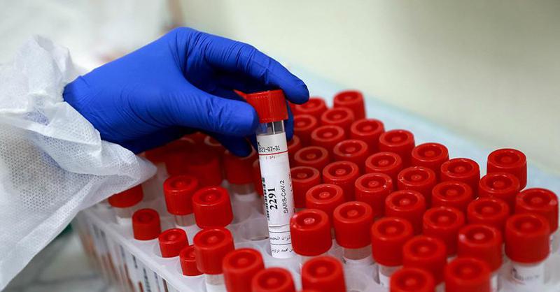 საქართველოში კორონავირუსით ინფიცირებულთა რაოდენობა 683-მდე გაიზარდა