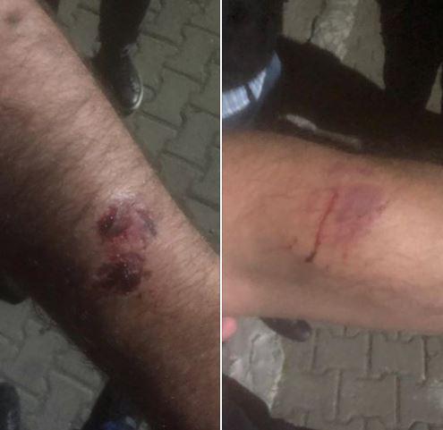 "პოლიციის თანამშრომლებს ნუ გვაგინებ" - ქუთაისში, კომენდანტის საათის დამრღვევმა სამართალდამცველებს ფიზიკური შეურაცხყოფა მიაყენა