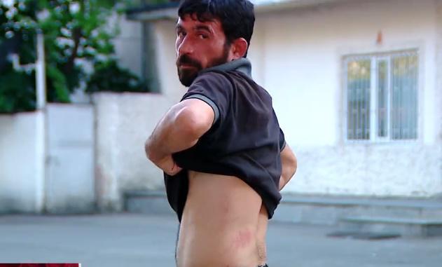 გარდაბანში სოფლის რწმუნებულმა მასთან დახმარების სათხოვნელად მისული მოქალაქე სცემა - ინციდენტის შემდეგ მურადოვს თანამდებობა დაატოვებინეს