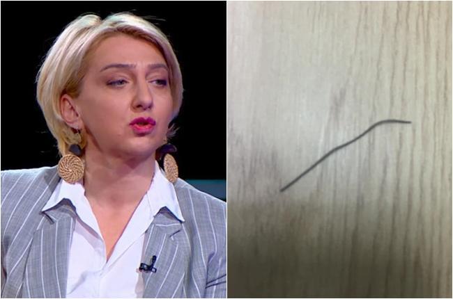 15 წლის მოზარდის მშობელი ამტკიცებს, რომ ბურგერის ჭამისას, მის შვილს ყელში რკინა გაეჩხირა - "ჩემი გოგონა გუშინ სიკვდილს გადაურჩა"