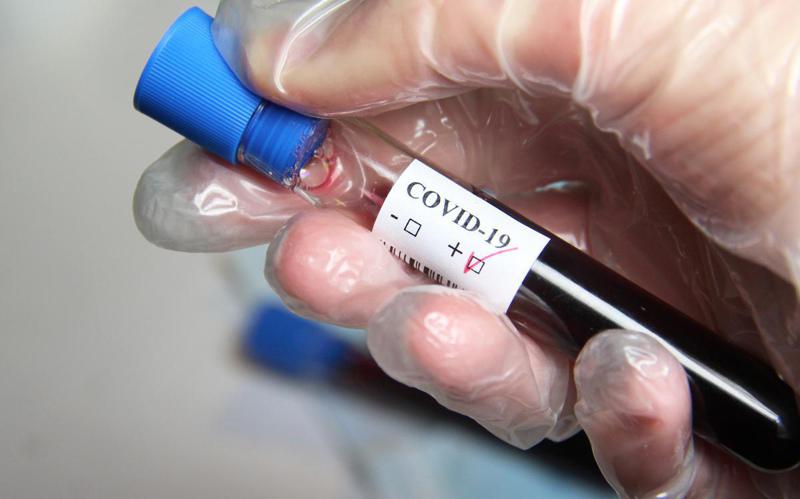 აფხაზეთში კორონავირუსით ერთი ადამიანი გარდაიცვალა