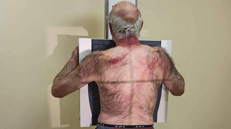 შემზარავი ყაჩაღობა შუახევში - 64 წლის "ფოსტალიონი" ნიღბიანებმა ხეზე მიაბეს, სცემეს და პენსიის თანხა გასტაცეს: "ერთს უთქვამს, მოდი დანა გავუყაროთ და მოვკლათო..."