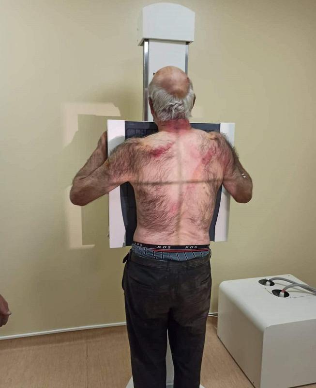 შუახევში 64 წლის "ფოსტალიონის" დაყაჩაღების ფაქტზე 2 პირი დააკავეს