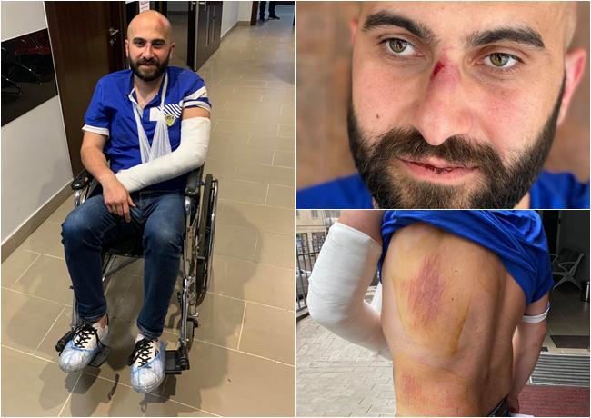 "მოგვიტანეს აბსურდული ანგარიში... როცა უარი განვაცხადე თანხის გადახდაზე, მცემეს, ბარის თანამშრომელი გოგო სკამს მირტყამდა" - რა გადახდა მომხმარებელს თბილისის ერთ-ერთ ბარში?