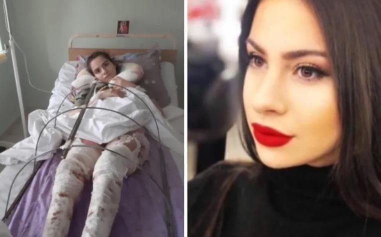 "ბიჭმა მისწერა, ცეცხლს წაგიკიდებ და გიყურებ, როგორ დაიწვებიო"- როგორ წაუკიდა 23 წლის გოგონას შეყვარებულმა ცეცხლი და როგორი ურთიერთობა  ჰქონდა წყვილს მანამდე