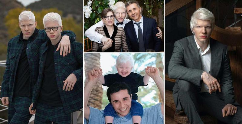 "მამაჩემს უკვირს, რომ ხალხს შეიძლება ჩვენი გარეგნობა არ მოსწონდეს. გვეუბნება, რომ ანგელოზებს ვგავართ" - ბერას ცხოვრების უცნობი დეტალები