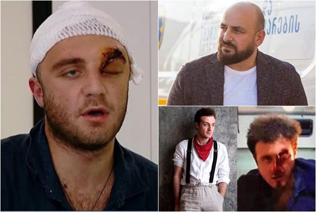 "თუ მკურნალობას არ დავასრულებ, შეიძლება მხედველობა აღარასდროს აღმიდგეს" - რას ითხოვს 2019 წლის 20 ივნისს დაშავებული და რაში ადანაშაულებს არჩილ თალაკვაძის ძმას