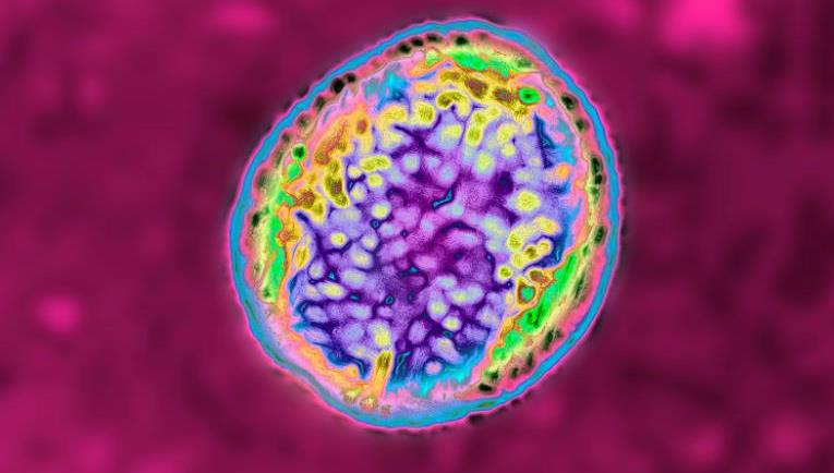 ჩინეთში, ბიოფარმაცევტული ქარხნიდან ბაქტერიების გაჟონვის გამო, ბრუცელოზმა იფეთქა - ინფიცირებულია ათასობით ადამიანი