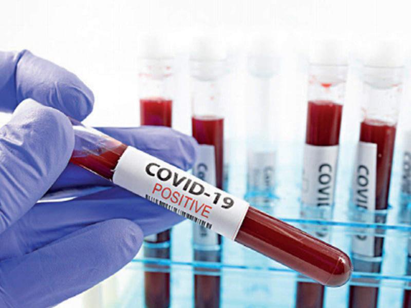 ქუთაისის #59-ე საოლქო კომისიის თავმჯდომარეს კორონავირუსი დაუდასტურდა