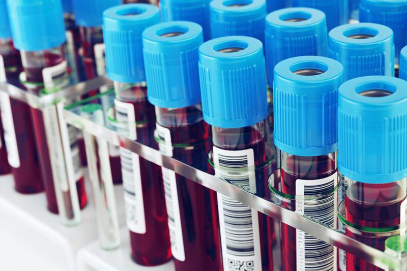 3801 ახალი შემთხვევა და 3200 გამოჯანმრთელებული - როგორია კორონავირუსის მაჩვენებლები ბოლო 24 საათში