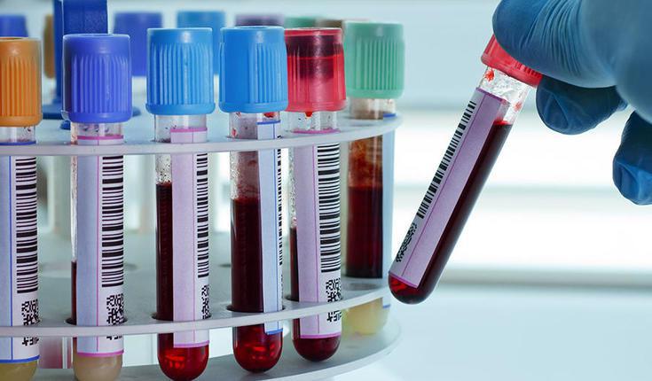 ინფიცირების 464 ახალი შემთხვევა და 7 გარდაცვლილი - როგორია კორონავირუსის განახლებული მონაცემები