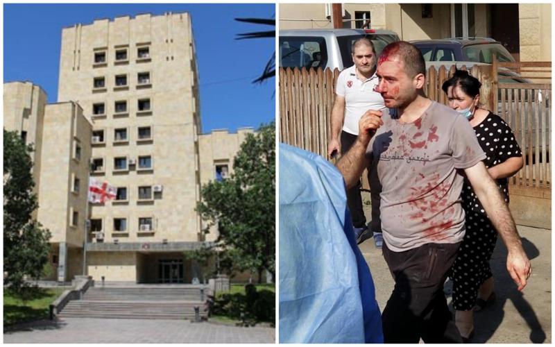 "მანქანის შეკეთებაზე წარმოშობილი შელაპარაკება დაპირისპირებაში გადაიზარდა" - პროკურატურამ პატრულის მიერ მოქალაქის ცემის ფაქტზე გამოძიება დაიწყო