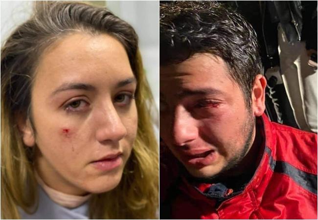 "ფრაგმენტებად ვხედავდი რა ხდებოდა, მაგრამ  არაფერი მესმოდა." - როგორია აქციის დაშლისას დაშავებული მედიის წარმომადგენლების ჯანმრთელობის მდგომარეობა