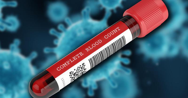 ბოლო დღე-ღამეში 29 341 კორონავირუსის ტესტი ჩატარდა - რამდენი ახალი ინფიცირებულია და რამდენმა დაამარცხა ვირუსი