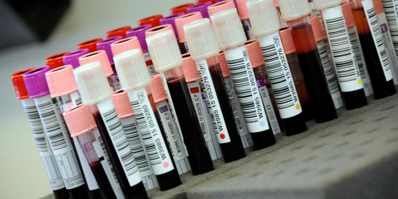 "1 354 - თბილისში, 410 - აჭარაში, 398 - იმერეთში" - საქართველოში კორონავირუსის 3020 ახალი შემთხვევაა