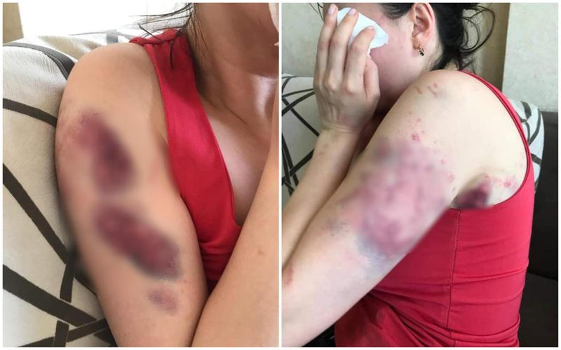 ექსკლუზივი: "ამ დღეში ჩამაგდო მამაკაცმა, რომელმაც მუცელში მყოფი შვილი მოკლა და ციხეშიც არ გაუშვეს" - ძალადობის მსხვერპლი ქალის მძიმე ინტერვიუ