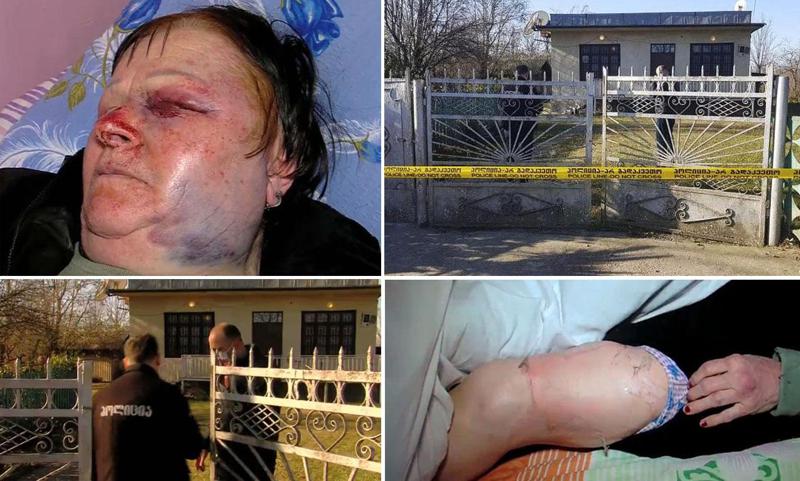 "ხელები შემიკრეს და დამაგდეს ქვემოთ, მუშტები მირტყეს. მერე უთო მოიტანეს..." - ხობში მომხდარი სასტიკი ყაჩაღობის დეტალები