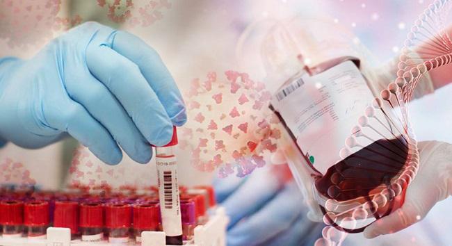 "ეს არის მკურნალობის ეფექტიანი და ხელმისაწვდომი მეთოდი" - რატომ ვერ ხერხდება საქართველოში covid 19-ის წინააღმდეგ პლაზმით მკურნალობის მასობრივად გამოყენება?