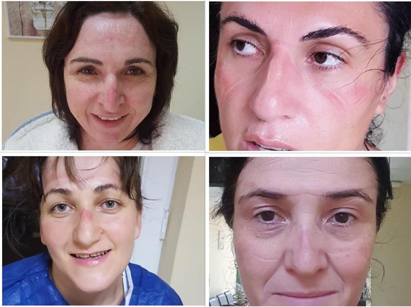 "არადა, რა ლამაზები ვიყავით...მოლებში რიგებში მდგომებს ჩვენი უჟანგბადობა არ ადარდებთ" - კორონავირუსთან მებრძოლი ქართველი ექიმების ფოტოები