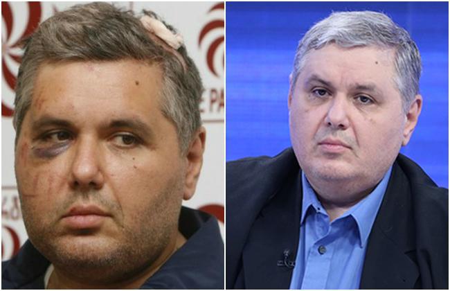 "აქამდე ამ თემაზე არ მილაპარაკია... თავზე ნაკერები ედო, მაგრამ ჭრილობა შიგნიდან ტალახით სავსე იყო და ისე გაკერილი" - დღემდე გაუხმაურებელი ამბები  კობა დავითაშვილის ცხოვრებიდან