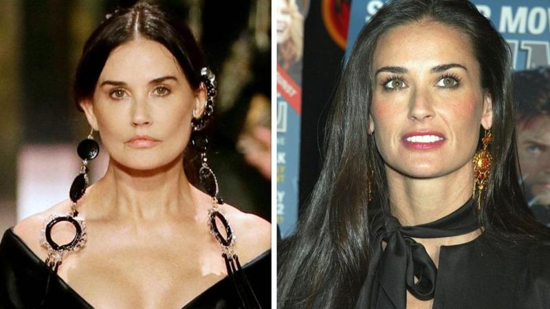 "რატომ, დემი... ნუთუ ეს შენ ხარ? პლასტიკური ქირურგია ღუპავს ადამიანებს" - სრულიად გარდასახული დემი მური Fendi-ს ჩვენებაზე ფანებმა ვერ იცნეს